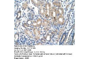Rabbit Anti-AGER Antibody  Paraffin Embedded Tissue: Human Kidney Cellular Data: Epithelial cells of renal tubule Antibody Concentration: 4. (RAGE 抗体  (C-Term))