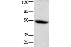Western Blot analysis of Mouse heart tissue using CD116 Polyclonal Antibody at dilution of 1:400 (CSF2RA 抗体)