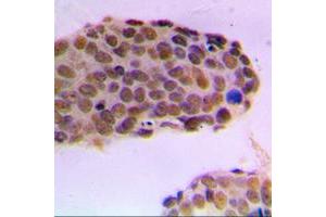 Immunohistochemistry (IHC) image for anti-Zinc Finger, MYND-Type Containing 8 (ZMYND8) (Center) antibody (ABIN7301454)