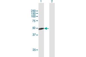 Western Blot analysis of TSG101 expression in transfected 293T cell line by TSG101 MaxPab polyclonal antibody. (TSG101 抗体  (AA 1-390))