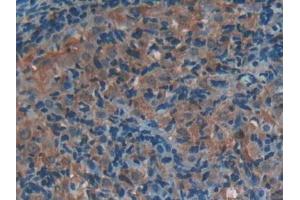 Used in DAB staining on fromalin fixed paraffin- embedded stomach tissue (P-Selectin 抗体  (AA 58-158))