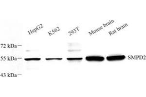 Western blot analysis of nSMase (ABIN7075702) at dilution of 1: 600 (SMPD2 抗体)