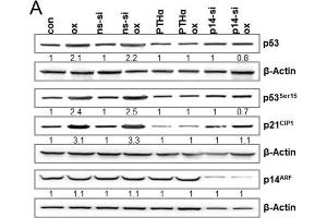 Western Blotting (WB) image for Goat anti-Mouse IgG antibody (HRP) (ABIN965415)
