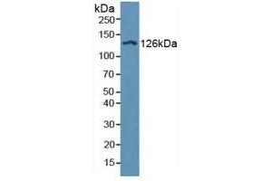 Detection of ITGaD in Human Serum using Polyclonal Antibody to Integrin Alpha D (ITGaD) (ITGAD 抗体  (AA 879-1099))