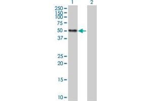 Western Blot analysis of CALR expression in transfected 293T cell line by CALR MaxPab polyclonal antibody. (Calreticulin 抗体  (AA 1-417))