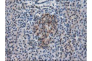 Immunohistochemical staining of paraffin-embedded Human pancreas tissue using anti-RBP1 mouse monoclonal antibody. (RBP1 抗体)