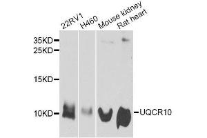 Western blot analysis of extracts of various cell lines, using UQCR10 antibody. (UQCR10 抗体  (AA 1-63))