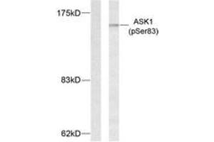 Western Blotting (WB) image for anti-Mitogen-Activated Protein Kinase Kinase Kinase 5 (MAP3K5) (pSer83) antibody (ABIN2888358) (ASK1 抗体  (pSer83))