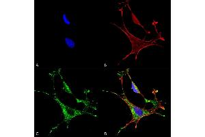 Immunocytochemistry/Immunofluorescence analysis using Mouse Anti-MMP9 Monoclonal Antibody, Clone S51-82 (ABIN2482808).