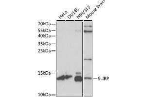 Western blot analysis of extracts of various cell lines, using SLIRP antibody. (SLIRP 抗体)