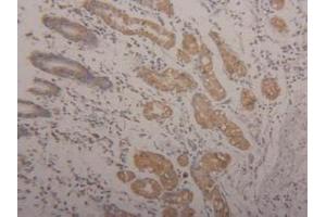 Detection of Arg2 in Human Stomach Tissue using Polyclonal Antibody to Arginase II (Arg2) (ARG2 抗体  (AA 23-354))