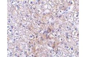 Immunohistochemistry of TRAF2 in human liver tissue with this product at 2. (TRAF2 抗体  (N-Term))