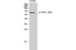 Western Blotting (WB) image for anti-K(lysine) Acetyltransferase 5 (KAT5) (pSer86) antibody (ABIN3182239)