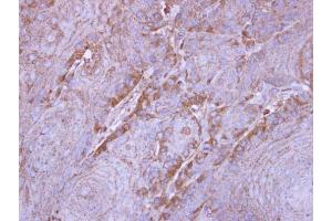IHC-P Image Immunohistochemical analysis of paraffin-embedded Cal27 xenograft, using SIRT3, antibody at 1:500 dilution. (SIRT3 抗体  (C-Term))