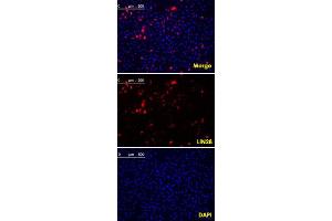 Confocal immunofluorescence analysis of methanol fixed HeLa cells were transfected with pMX construct of human LIN28, cells were analyzed ~62 hours after transfection. (LIN28A 抗体  (AA 93-209))