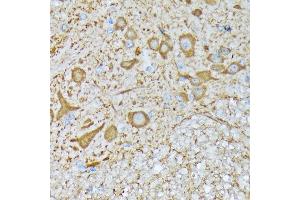 Immunohistochemistry of paraffin-embedded mouse spinal cord using CaMKII Rabbit mAb (ABIN3015112, ABIN3015113, ABIN1679768 and ABIN1679769) at dilution of 1:100 (40x lens). (CAMK2B 抗体)