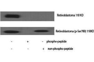 Western Blot (WB) analysis of specific cells using Phospho-Rb (S780) Polyclonal Antibody. (Retinoblastoma 1 抗体  (pSer780))