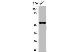 Western Blot analysis of HeLa cells using CREB3L2 Polyclonal Antibody (CREB3L2 抗体  (Internal Region))