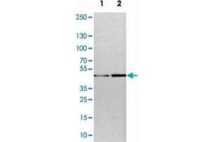 Western blot analysis of cell lysates with TOX polyclonal antibody . (TOX 抗体)