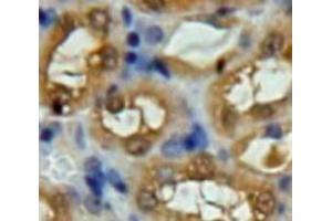 Used in DAB staining on fromalin fixed paraffin-embedded Kidney tissue (UCHL5 抗体  (AA 2-316))