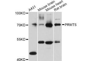 Western blot analysis of extracts of various cell lines, using PRMT5 Antibody (ABIN5970714) at 1:3000 dilution. (PRMT5 抗体)