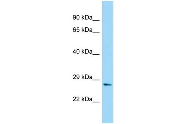 NUDT7 抗体  (N-Term)