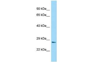 WB Suggested Anti-NUDT7 Antibody Titration: 1. (NUDT7 抗体  (N-Term))