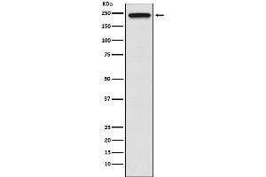 Western blot analysis of TRPM7 expression in HeLa cell lysate.