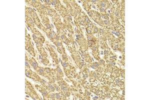 Immunohistochemistry (Paraffin-embedded Sections) (IHC (p)) image for anti-ATP Synthase, H+ Transporting, Mitochondrial F1 Complex, beta Polypeptide (ATP5B) (AA 230-529) antibody (ABIN6137326)