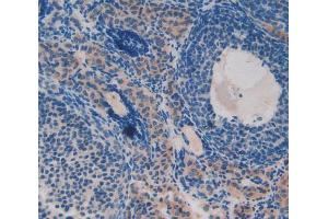 Used in DAB staining on fromalin fixed paraffin- embedded ovary tissue (PKIG 抗体  (AA 1-76))