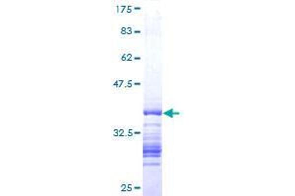 TGIF2LX Protein (AA 101-190) (GST tag)