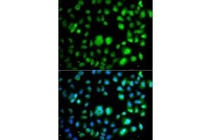 Immunofluorescence analysis of A549 cell using TET3 antibody. (TET3 抗体)