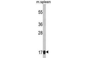 Western blot analysis of RS18 Antibody (Center) Cat. (RPS18 抗体  (Middle Region))
