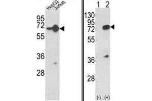 (LEFT) Western blot analysis of HNRPL Antibody (Center) in HepG2, Jurkat cell line lysates (35ug/lane). (HNRNPL 抗体  (Middle Region))