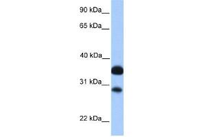 WB Suggested Anti-CITED2 Antibody Titration:  0. (CITED2 抗体  (N-Term))