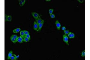 Immunofluorescent analysis of HepG2 cells using ABIN7147039 at dilution of 1:100 and Alexa Fluor 488-congugated AffiniPure Goat Anti-Rabbit IgG(H+L) (Cation Channel Sperm-Associated Protein Subunit epsilon (CATSPERE) (AA 601-832) 抗体)
