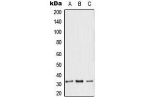 Western Blotting (WB) image for anti-Solute Carrier Family 25 (Mitochondrial Carrier, Adenine Nucleotide Translocator), Member 6 (SLC25A6) (Center) antibody (ABIN7299070)