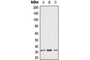 Western blot analysis of ANT3 expression in HeLa (A), Raw264. (SLC25A6 抗体  (Center))