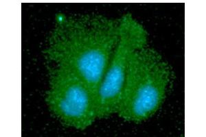 ICC/IF analysis of SGTA in Hep3B cells line, stained with DAPI (Blue) for nucleus staining and monoclonal anti-human SGTA antibody (1:100) with goat anti-mouse IgG-Alexa fluor 488 conjugate (Green). (SGTA 抗体  (AA 1-313))