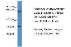 WB Suggested Anti-OR2T29  Antibody Titration: 0. (OR2T29 抗体  (C-Term))