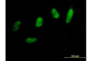 Immunofluorescence of purified MaxPab antibody to SNAI2 on HeLa cell. (SLUG 抗体  (AA 1-268))