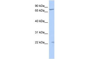 WB Suggested Anti-STRA6 Antibody Titration:  0. (STRA6 抗体  (N-Term))