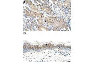 Immunohistochemical staining (Formalin-fixed paraffin-embedded sections) of human kidney (A) and human skin (B) with GEM polyclonal antibody  at 4-8 ug/mL working concentration. (GEM 抗体  (C-Term))