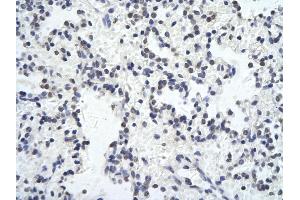 Rabbit Anti-ZNF652 antibody Catalog Number: ARP31678_P050  Paraffin Embedded Tissue: Human Lung cell  Cellular Data: Epithelial cells of renal tubule Antibody Concentration:  4. (ZNF652 抗体  (N-Term))
