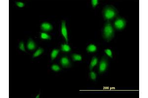 Immunofluorescence of purified MaxPab antibody to MDM4 on HeLa cell. (MDM4-binding Protein 抗体  (AA 1-490))