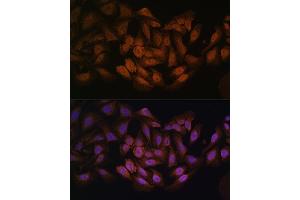 Immunofluorescence (IF) image for anti-CCHC-Type Zinc Finger, Nucleic Acid Binding Protein (CNBP) (C-Term) antibody (ABIN7266165)