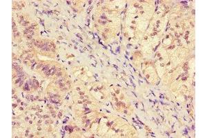 Immunohistochemistry of paraffin-embedded human adrenal gland tissue using ABIN7169176 at dilution of 1:100 (SGK1 抗体  (AA 247-406))