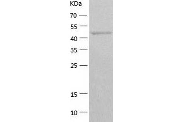 GTF2E1 Protein (AA 1-439) (His tag)