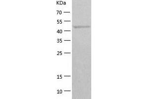 Western Blotting (WB) image for General Transcription Factor IIE, Polypeptide 1, alpha 56kDa (GTF2E1) (AA 1-439) protein (His tag) (ABIN7123074) (GTF2E1 Protein (AA 1-439) (His tag))