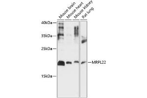 Western blot analysis of extracts of various cell lines, using MRPL22 antibody (ABIN7268563) at 1:1000 dilution. (MRPL22 抗体  (AA 97-206))
